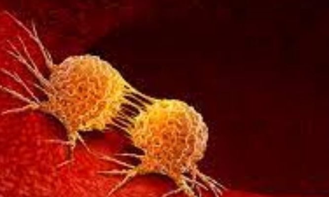 Know how to cure deadly diseases like cancer through astrology