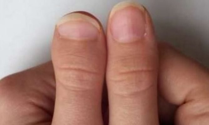 Thumb Palmistry: Know with your thumb, how will be your luck.